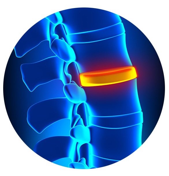 decompression diabetic nerve pain in foot
