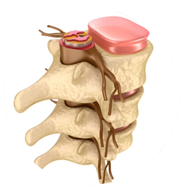 chiropractic diabetic nerve pain in foot