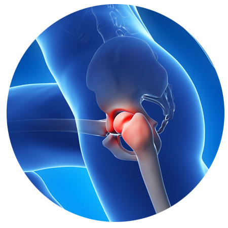 hip diabetic nerve pain in foot